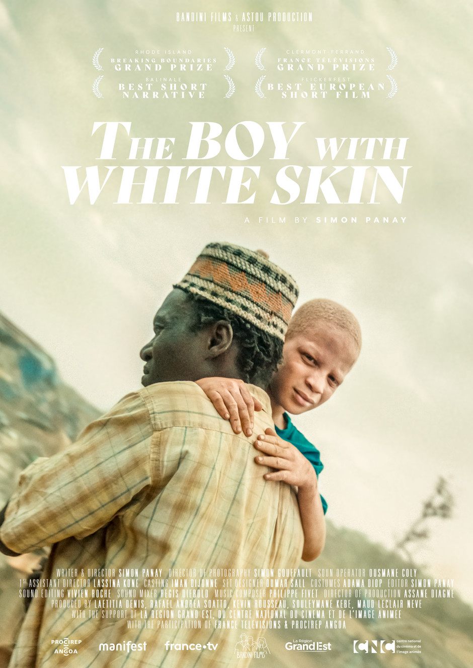 An Enchanting Masterpiece: THE BOY WITH WHITE&nbsp;SKIN